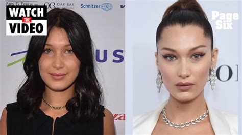 bella hadid nose job regret.